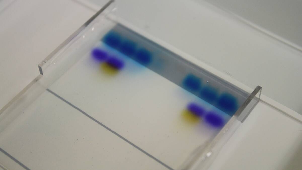 The result after the Electrophoresis machine did its work. Blue dye separated into purple and yellow.