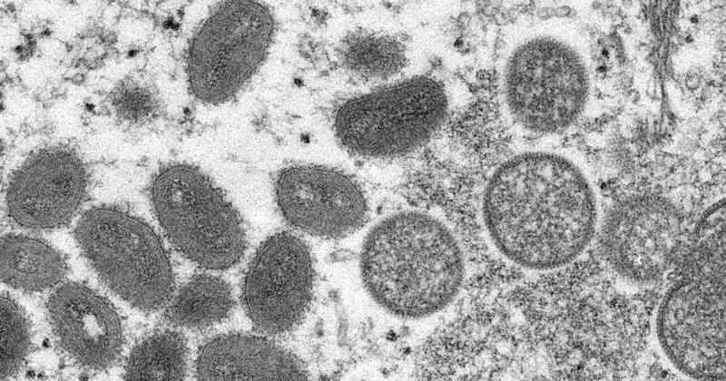 Nigeria records 62 monkeypox cases in 2022